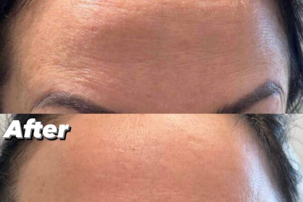 neurotoxin-2 neurotoxin-2